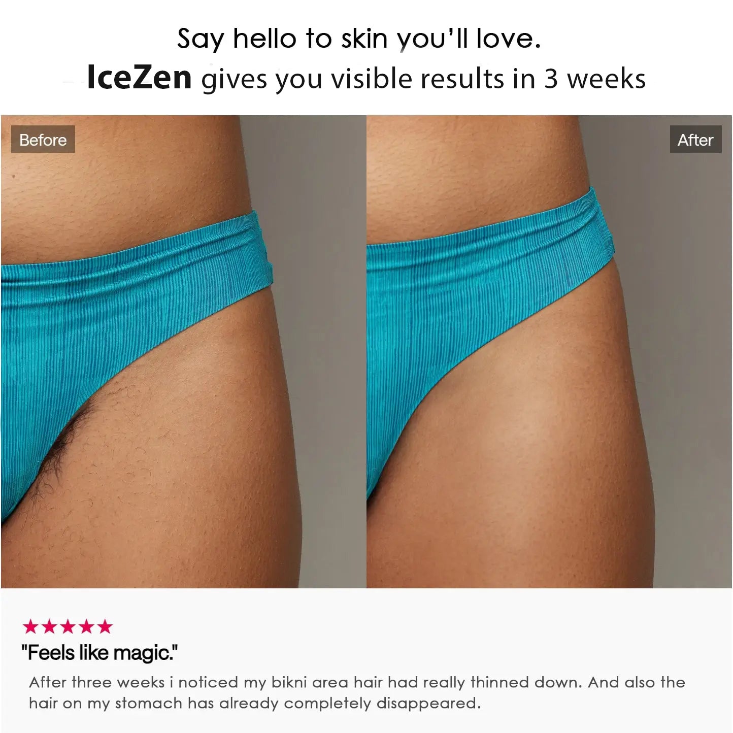 IceZen Air+ Painless IPL Hair Removal Device