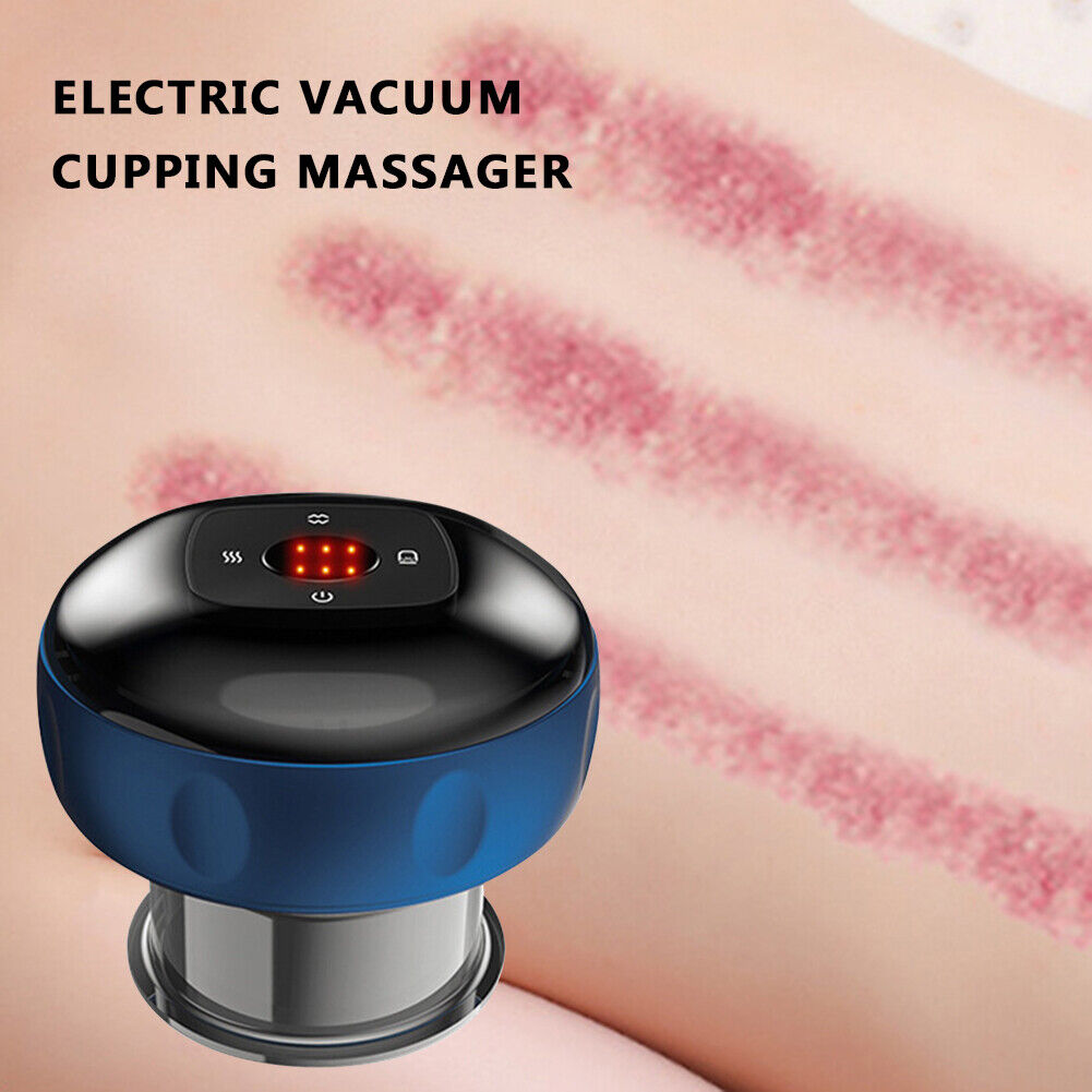 Anti-Cellulite Vacuum Cupping